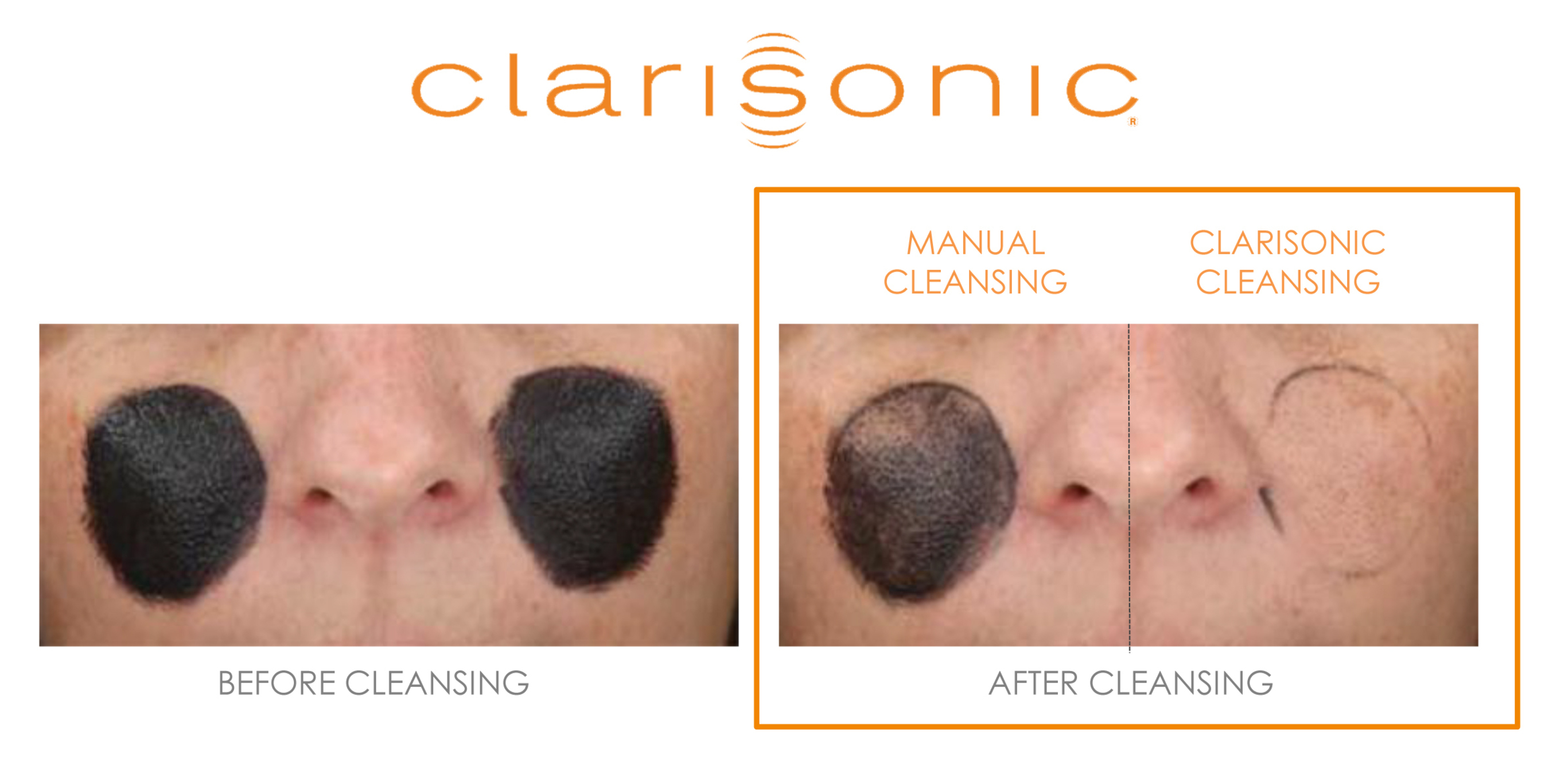 In an eye-opening study, Clarisonic used a tinted pollution marker comprised of pollutants from PM 0.3 - PM 5.0 to investigate the efficacy of removing barely visible pollution particles.  The findings proved the Clarisonic cleansing device has the cleansing power to remove 30 times more harmful age-accelerating pollution than manual cleansing.  (PRNewsFoto/Clarisonic)