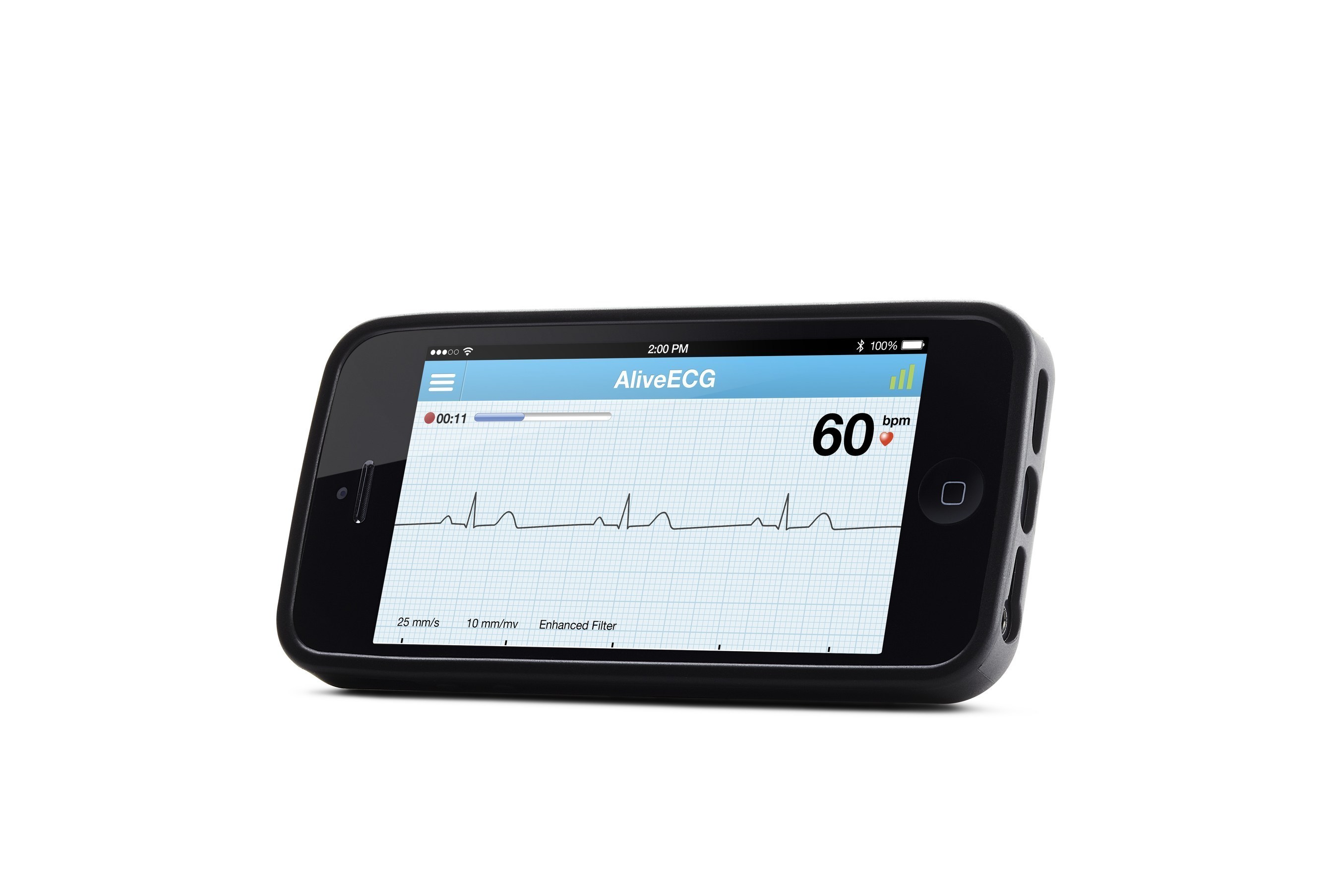 AliveCor Heart Monitor (PRNewsFoto/AliveCor, Inc.)
