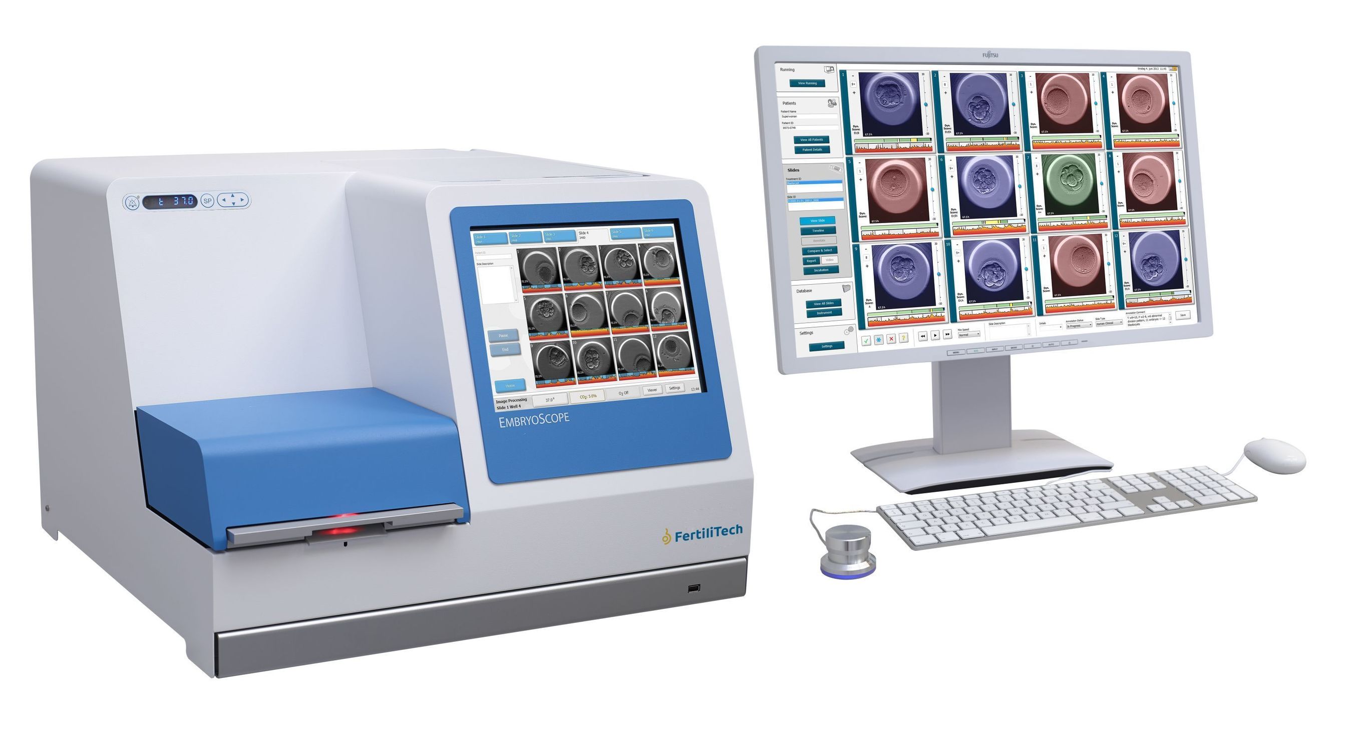 Unisense FertiliTech A/S : EmbryoScope(TM) time-lapse system (PRNewsFoto/Unisense FertiliTech A_S)