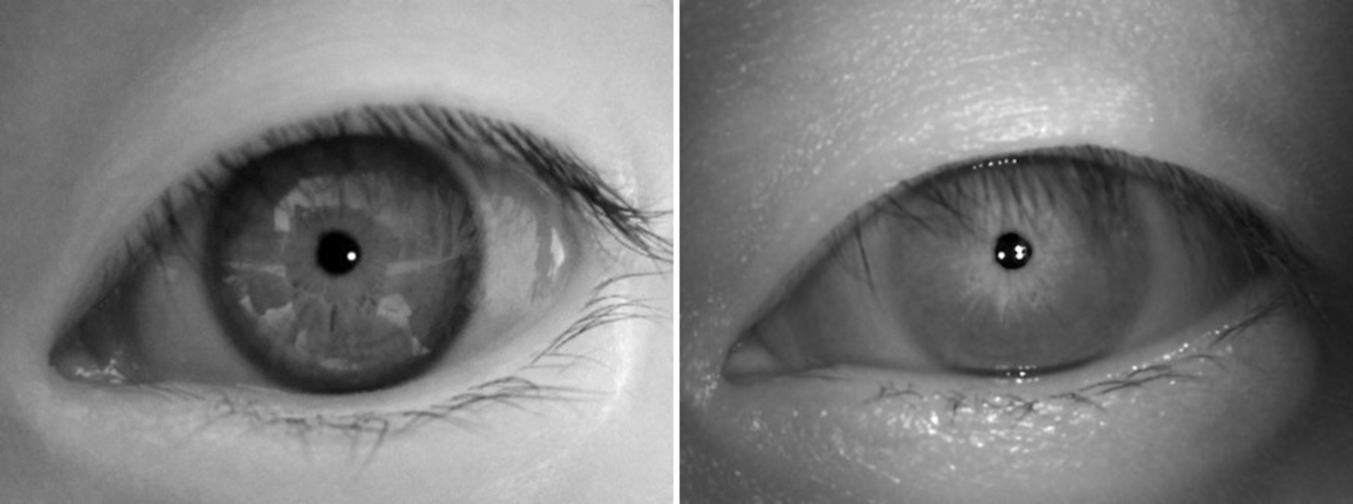 Left and right images are taken under identical environments of more thanover 100,000 lux. The left iris image was captured with a conventional iris camera, whereas the right image was with IriTech's outdoor capturing technology integrated camera. The left iris image shows reflections that will likely degrade the matching accuracy, whereas the right image does not have any reflections.
