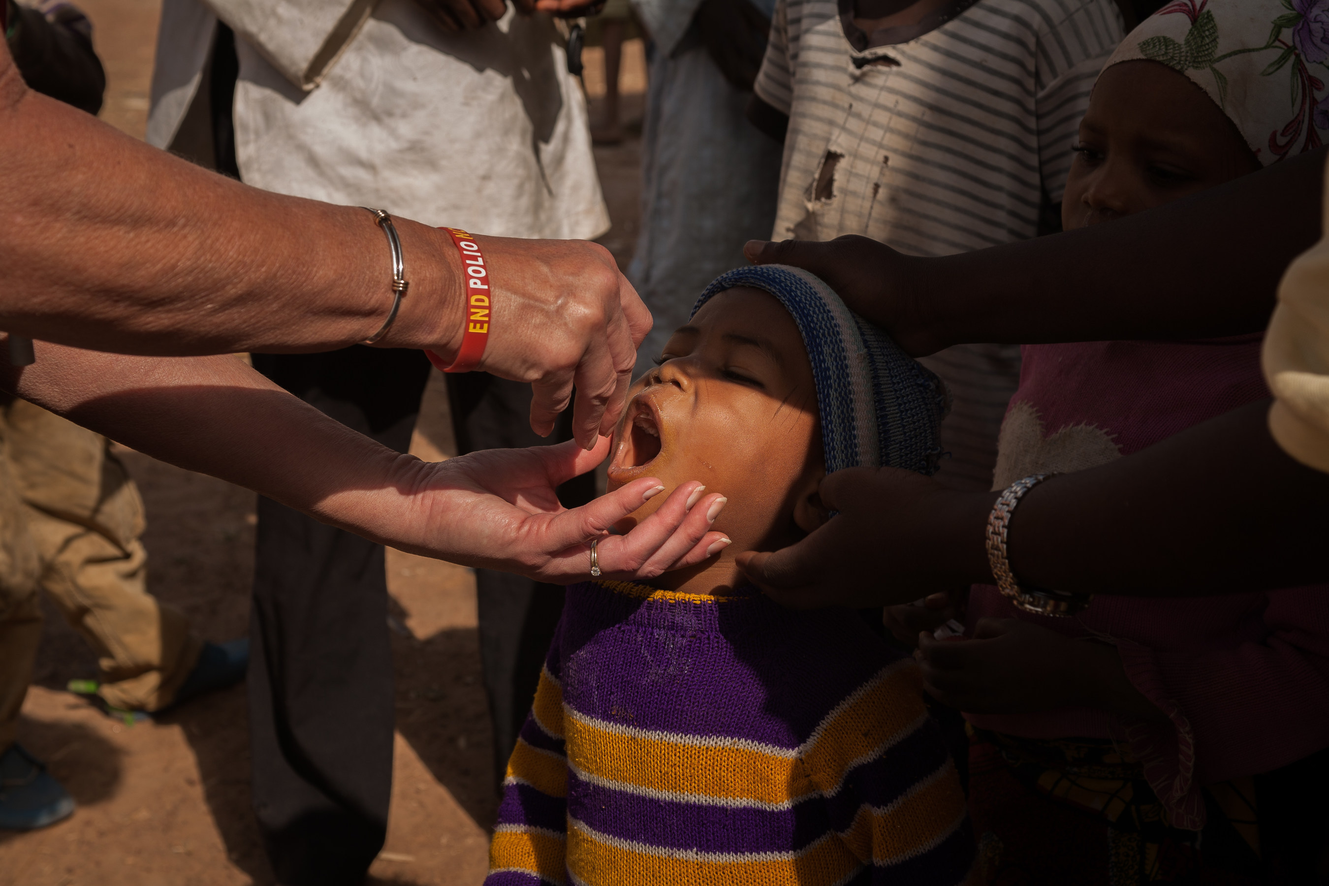 Drops of the oral polio vaccine are given to a child in Nigeria. Photo Credit: Ruth McDowall for Rotary International