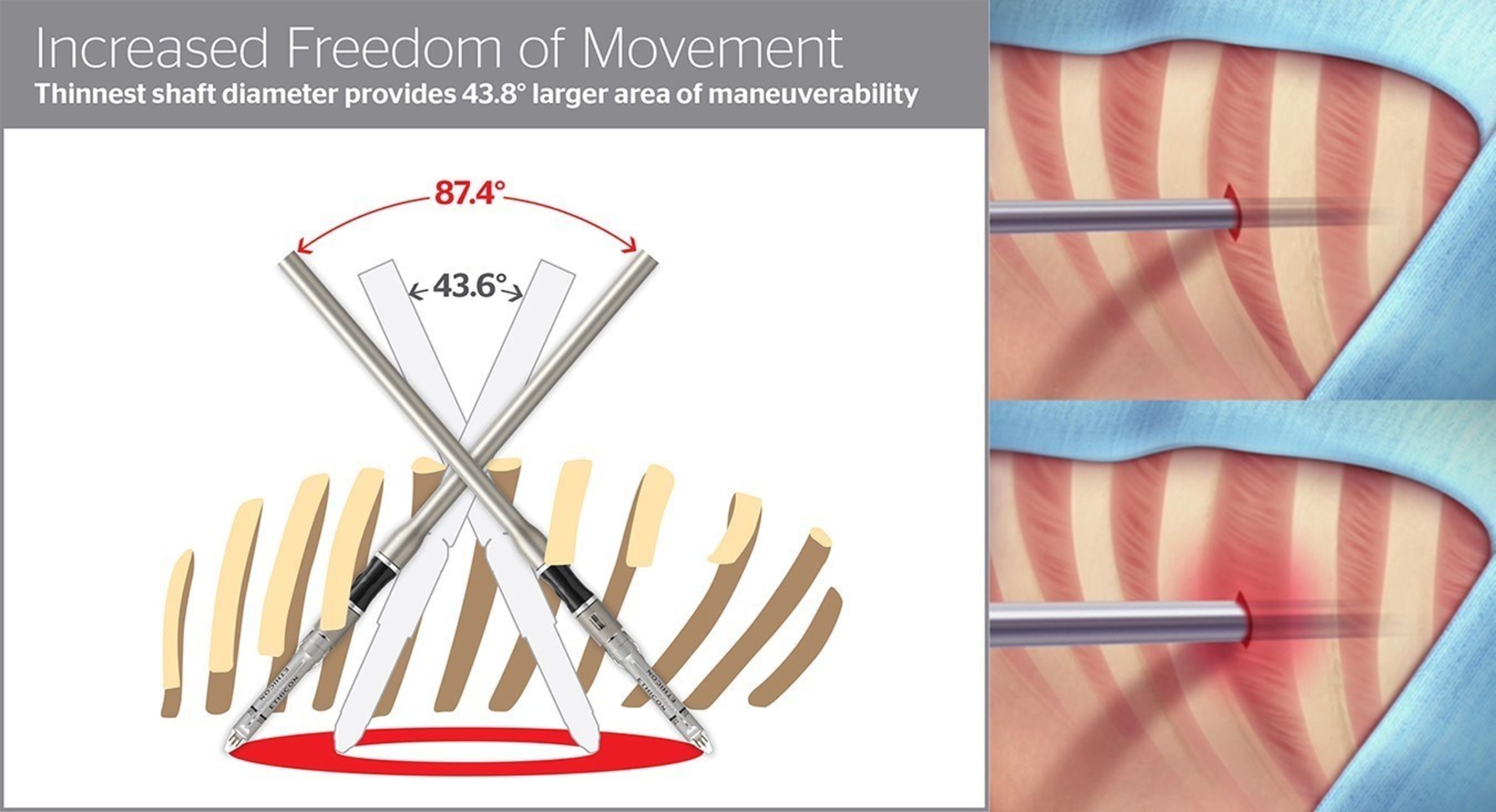 Increased Freedom of Movement