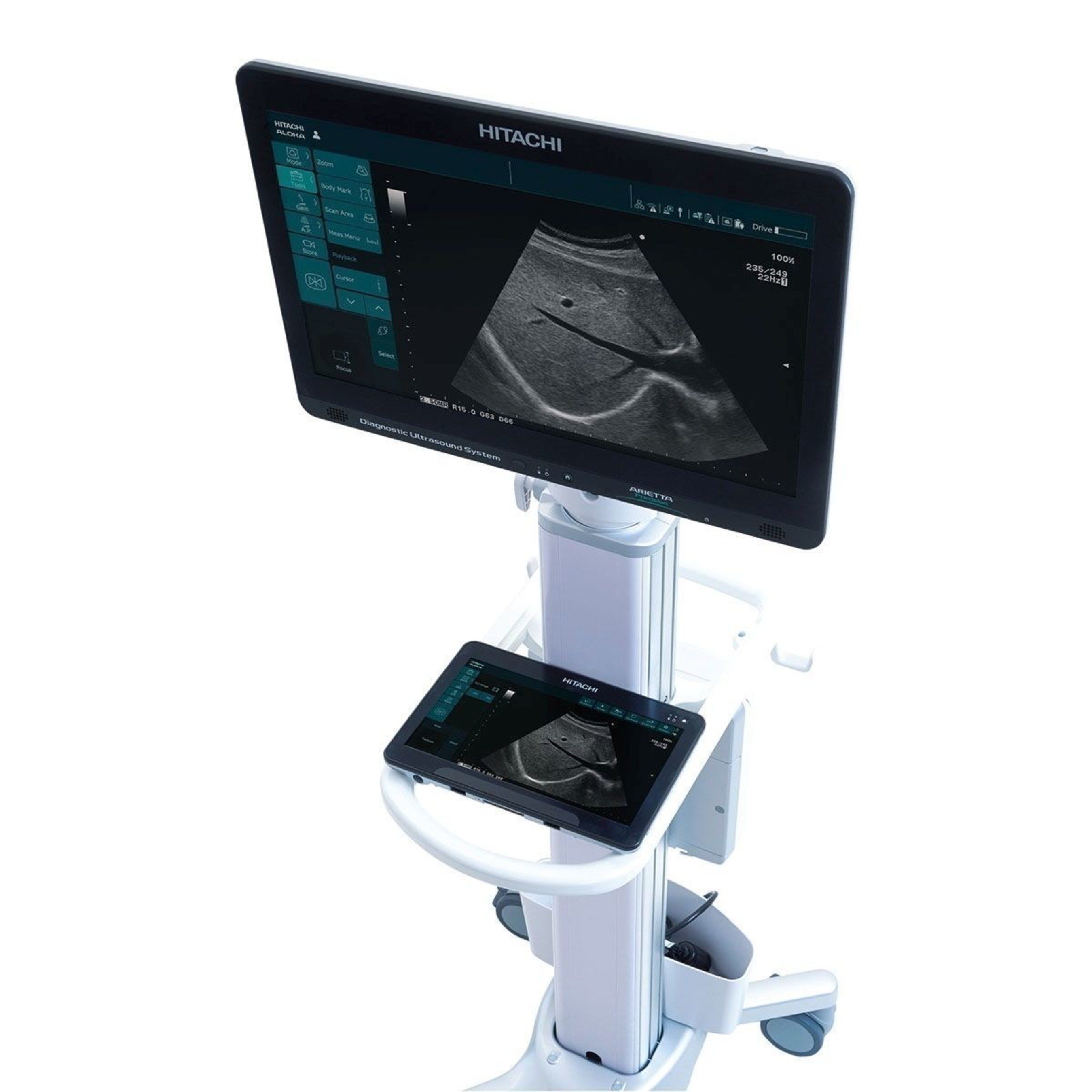 ARIETTA Precision. Hitachi Aloka launches two new, highly flexible Diagnostic Ultrasound Systems, ARIETTA Precision and ARIETTA Prologue. (PRNewsFoto/Hitachi Medical Systems Europe) (PRNewsFoto/Hitachi Medical Systems Europe)