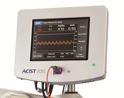 The new ACIST|RXi' Rapid Exchange FFR System - the world-s first Rapid Exchange FFR system - features new technology designed to provide physicians with a fast and easy way to perform Fractional Flow Reserve (FFR) procedures.