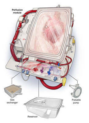 The Organ Care System (OCS(TM)) Heart (PRNewsFoto/TransMedics, Inc.)