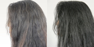 Scientific Discovery Reverses Gray Hair To Its Natural Color -- Invented By  The Warner Babcock Institute