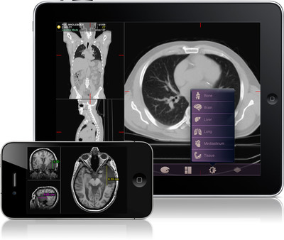 Mobile MIM, First FDA-Cleared Diagnostic Medical Imaging App, Now Available on the U.S. App Store