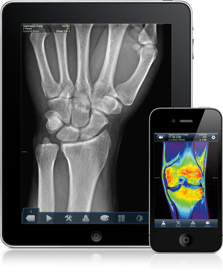 MIM's Medical Imaging App for Patients, VueMe, Now Available on iPad, iPhone, and iPod touch