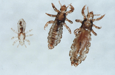 Head Lice Returns to School: Five Tips to Avoid Panic and Worry