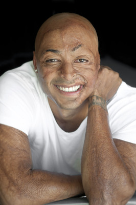 Dancing With The Stars Champion J.R. Martinez to Appear at National Rehabilitation Hospital Gala Victory Awards®, Thursday, Dec. 1
