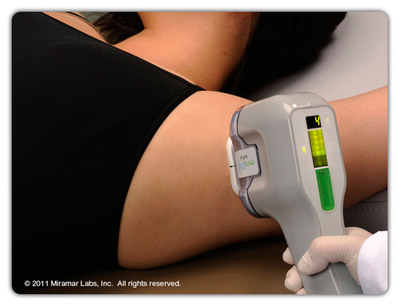 Miramar Labs Launches miraDry® System to Treat Excessive Underarm Sweat