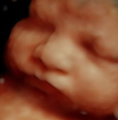 Prenatal Imaging Center Acquires 'Latest and Greatest' Ultrasound Technology, Only Imaging Center in Kansas and Missouri to Offer HDlive