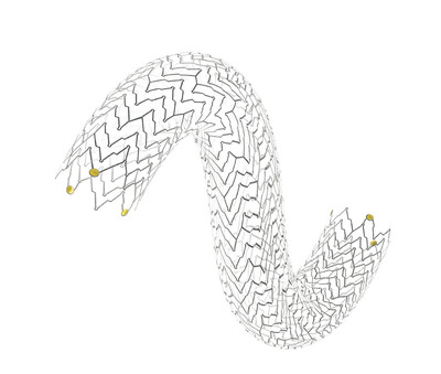 Terumo Completes U.S. Patient Enrollment in the OSPREY Trial to Evaluate the MISAGO Self-expanding Stent