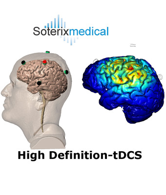 Soterix Medical Inc. reports positive results from High-Definition tDCS Fibromyalgia Trial at Harvard Medical School