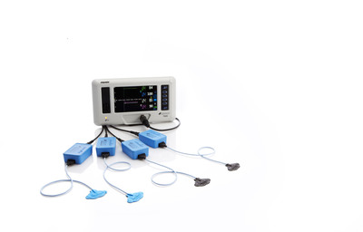 Nonin Medical Selected as Exclusive Provider of Cerebral/Somatic Oximetry Systems to Leading Pediatric Hospitals in Poland