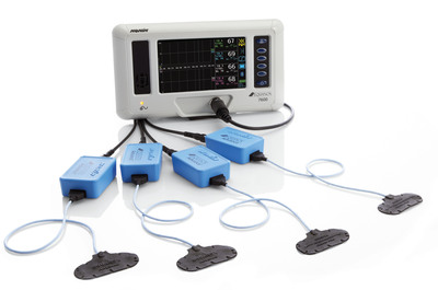 Terumo Cardiovascular Systems Announces U.S. Distribution Agreement with Nonin Medical for Nonin's EQUANOX™ 7600 Regional Oximetry System