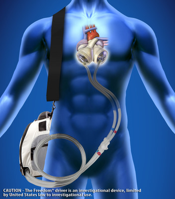 The SynCardia temporary Total Artificial Heart powered by the Freedom(R) portable driver is becoming the new standard of care for end-stage heart failure affecting both sides of the heart (biventricular failure).  (PRNewsFoto/SynCardia Systems, Inc.)