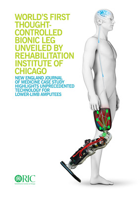 World's First Thought-Controlled Bionic Leg Unveiled by Rehabilitation Institute of Chicago
