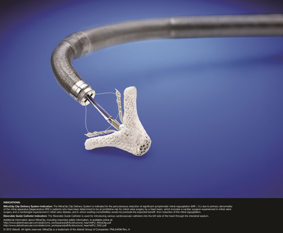 Abbott's First-In-Class MitraClip® Device Now Available for U.S. Patients