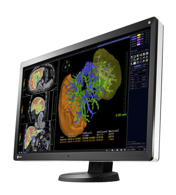 EIZO Releases 30-inch 6 Megapixel Monitor for Multi-Modality Applications