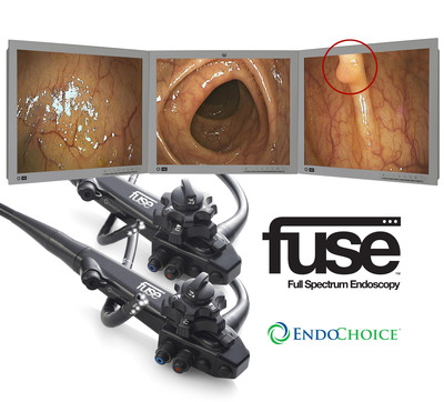 EndoChoice Announces Health Canada License for Fuse Endoscopy System in Canada