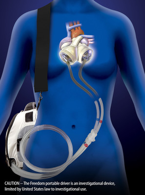 Top U.S. Heart Surgeons Share Best Practices for Using the SynCardia Total Artificial Heart