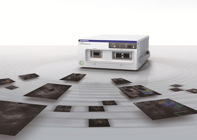 EU-ME2 brings superb clarity to EUS and EBUS procedures, supporting better detection and characterization of lesions in the gastrointestinal tract and airways.