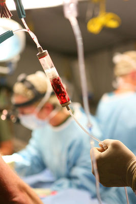 Blacks in U.S. More Likely to Receive Unnecessary and Dangerous Surgical Blood Transfusions, UAlbany Study Finds