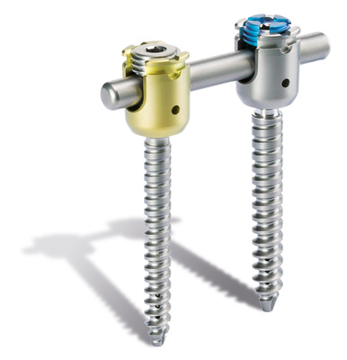 ulrich medical USA® Releases New Spinal Implant for U.S. Market: uCentum® Comprehensive Posterior System