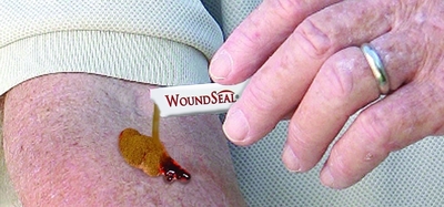 WoundSeal is the only first aid product that stops minor external bleeding through the creation of an instant scab (or seal) once the powder combines with the wound’s own blood.