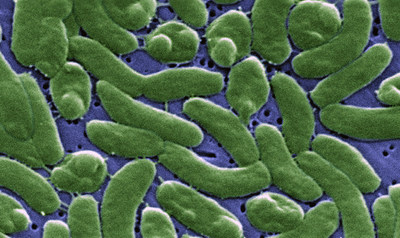 Vibrio vulnificus is a bacterium commonly found in warm, brackish waters and estuaries, although with the warming of the oceans, has been detected in more northern waters as well.