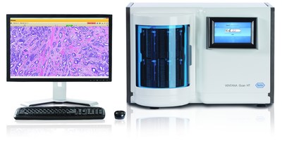 Full digitization of the anatomic pathology lab is here with the VENTANA System for Primary Diagnosis