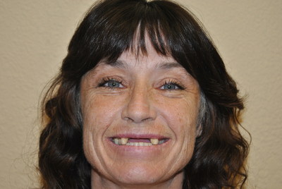 Meet Ms. Scott - A Rodeo Dental Patient And Domestic Violence Survivor