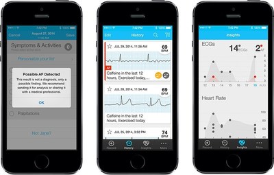 AliveCor Launches New App to Auto Detect Atrial Fibrillation in an ECG Recording