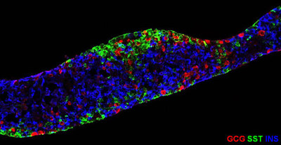 After implant into animals in pre-clinical studies of VC-01, the PEC-01 cells mature into the various human cell types of the endocrine pancreas, including those expressing insulin (INS, blue), glucagon (GCG, red), and somatostatin (SST, green).