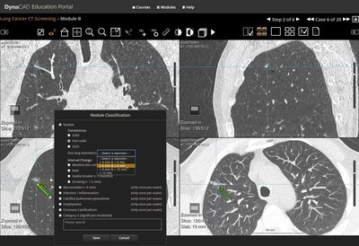 This total solution is comprised of products and services that enable health care providers to implement and manage a comprehensive computed tomography (CT) lung screening program which tracks and guides patients across the health continuum.
