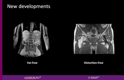 New developments include fat-free and distortion-free imaging.