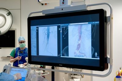 Philips Launches Innovative 3D Navigation System to Enhance Minimally Invasive Treatment of Vascular Disease