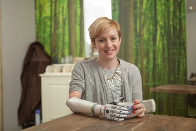 First UK User Receives World's Most Lifelike Bionic Hand