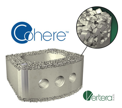 Vertera Spine Announces FDA Clearance of the First Surface Porous PEEK Interbody Fusion Device