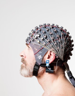 Un traitement révolutionnaire contre les accidents vasculaires cérébraux basé sur l'interface ordinateur-cerveau et la neurotechnologie