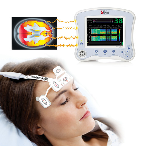 Masimo Obtains CE Mark for SEDLine, Launches EEG-Based Brain Function ...
