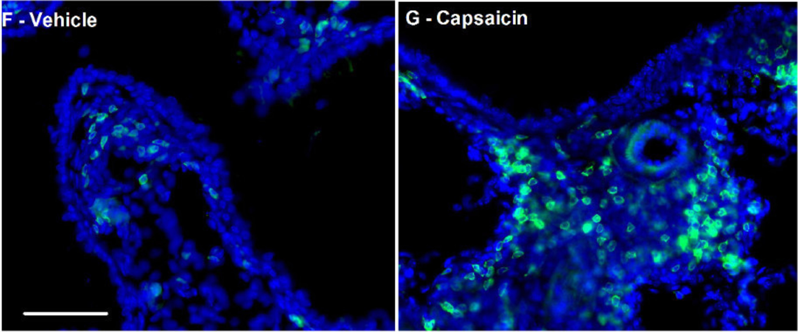 Activation of nociceptors, done for study purposes with a compound called capsaicin, promotes the infiltration of immune cells into the lung (right) as compared with control (left).