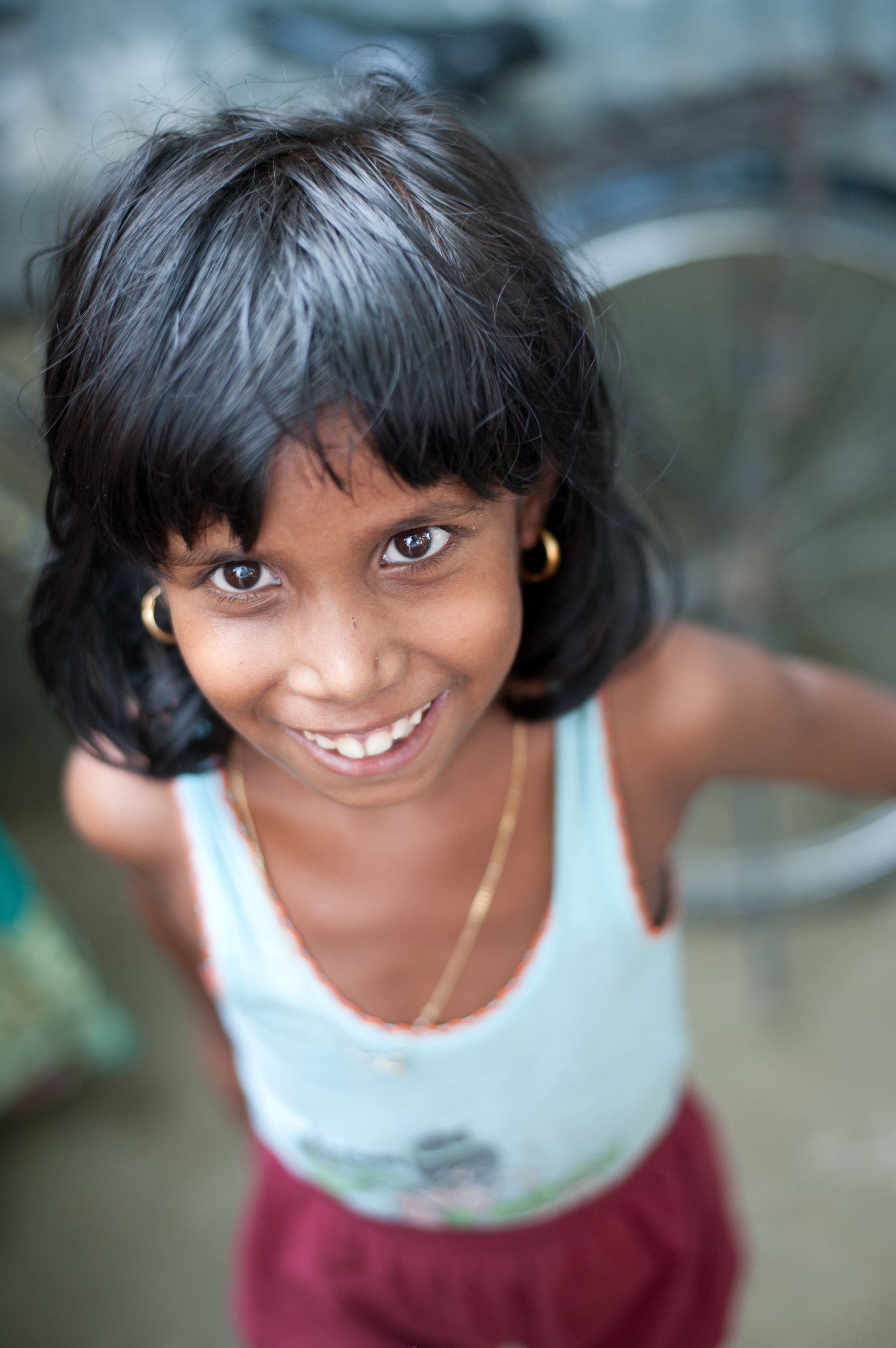 A young patient after a successful cataract surgery in Guwahati, India.