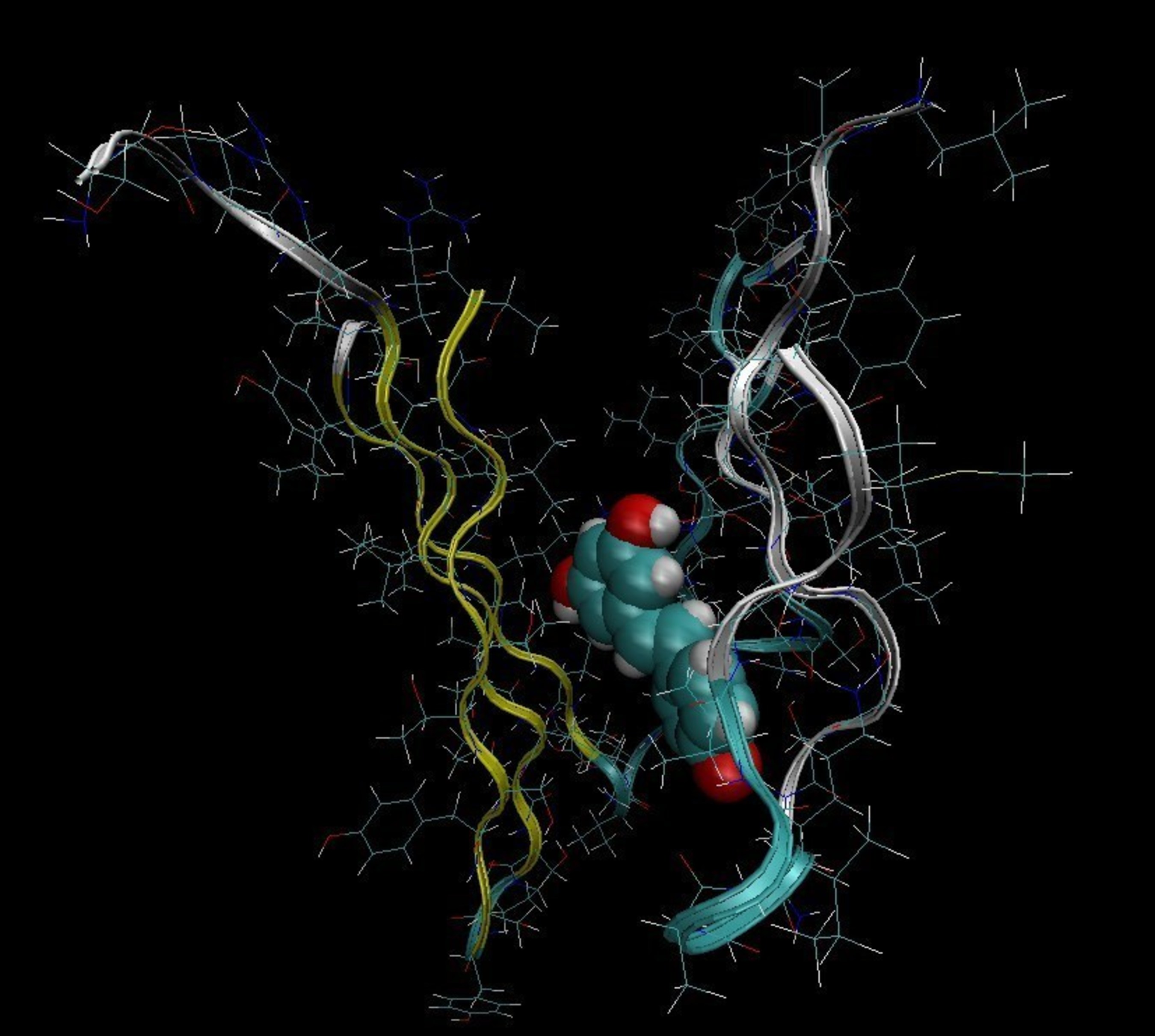 A computer simulation of a drug binding to a mis-folded amyloid protein.