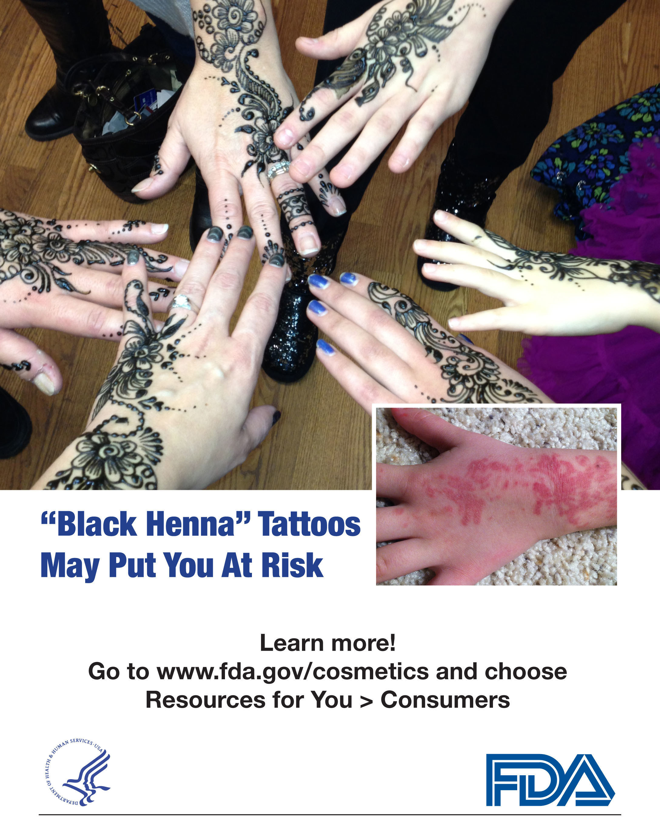 "Black Henna" Tattoos May Put You at Risk