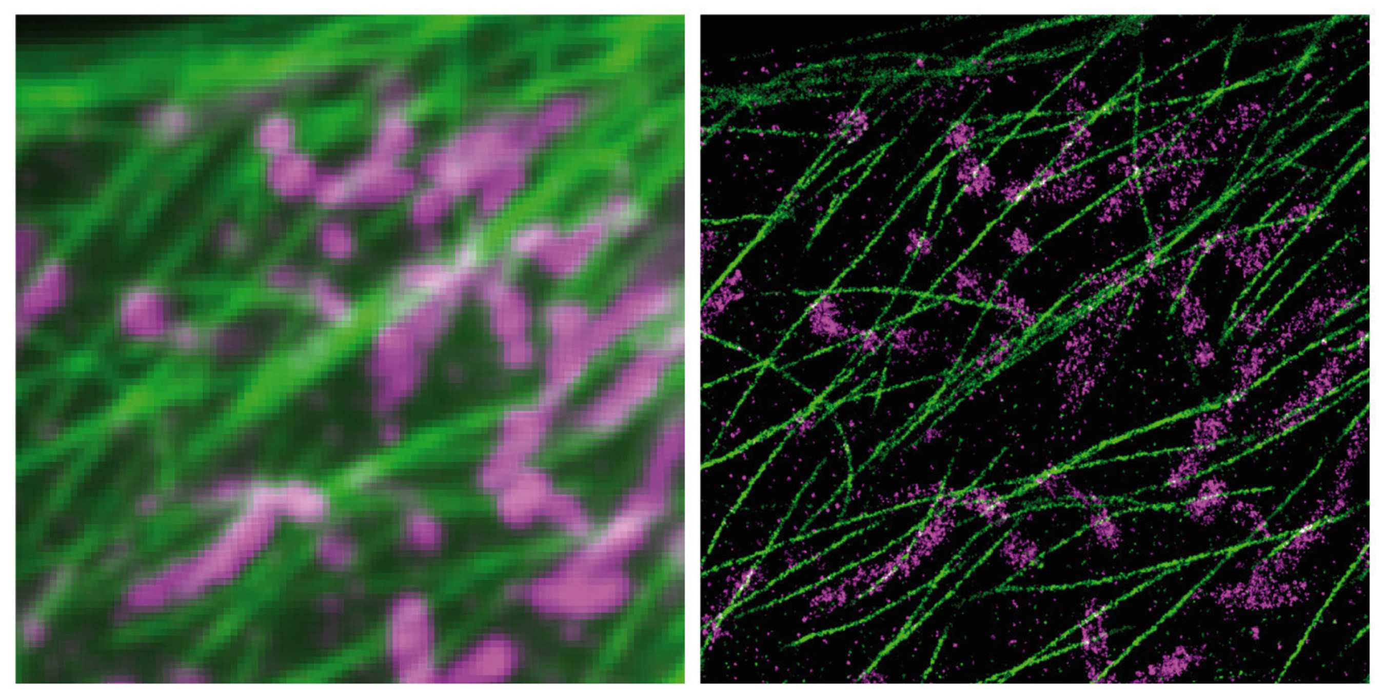 DNA-PAINT and Exchange-PAINT technologes (right image) dramatically improve the limited resolution abilities of single-molecule microscopes (left image).  Shown are structures of thin microtubule fibers (green) that build a skeleton within cells and mitochondria (magenta) as the cell's biochemical powerhouses both turned from blurry into super-sharp molecular images. Credit: Wyss Institute at Harvard University.