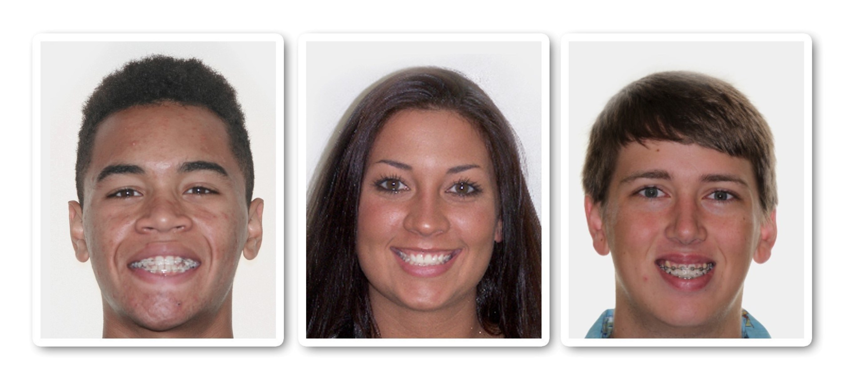 Orthodontic patients (from left to right) Rey Rivera, Tiffany Tapler and Chase Bethay choose AcceleDent to speed up their treatment. AcceleDent is an FDA-cleared, Class II medical device that speeds orthodontic tooth movement by as much as 50 percent.