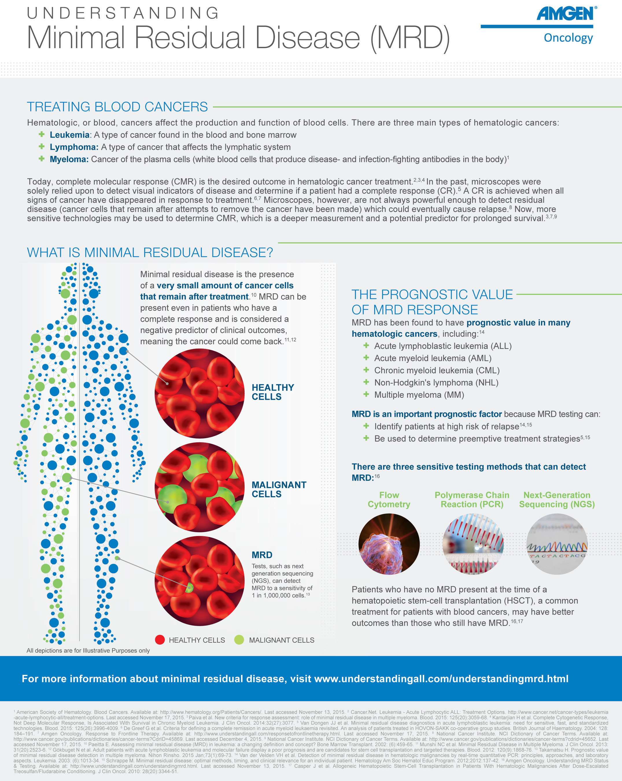 Infographic - Understanding Minimal Residual Disease (MRD)
