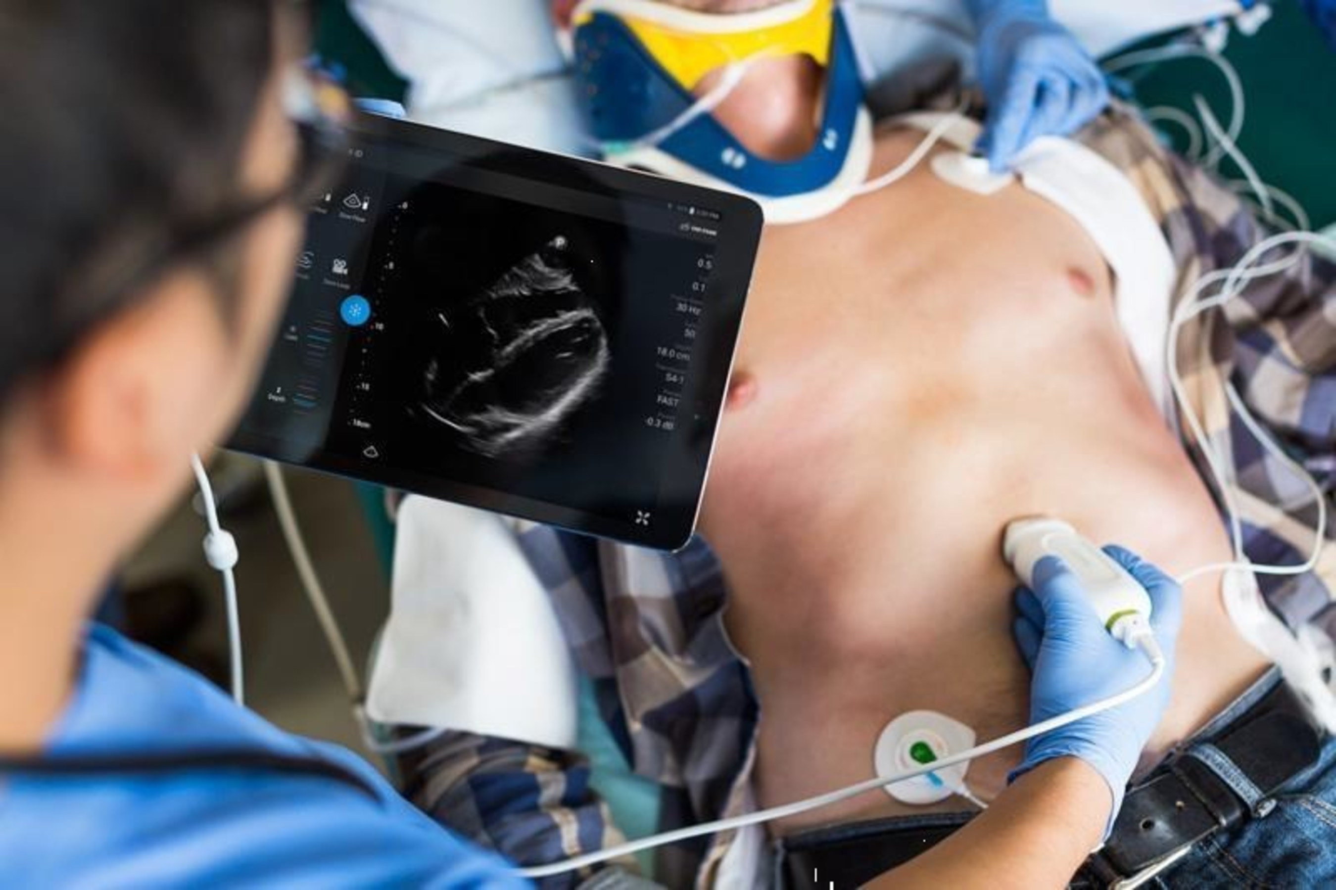 Philips' smart device powered ultrasound solution, Lumify, now includes the S4-1 phased array transducer, offering new capabilities, for emergency care situations.